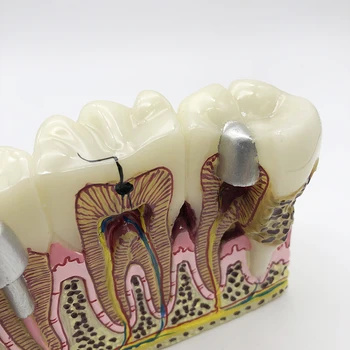 Стоматологично оборудване Анатомическая модел на зъбите Лепене на зъбите при кариесе Обучение зубному делото на горната челюст